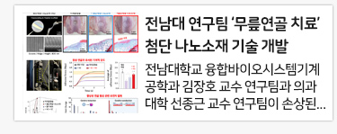 전남대 연구팀 ‘무릎연골 치료’ 첨단 나노소재 기술 개발